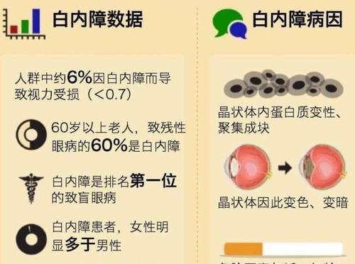 狗狗白内障的病因全解析（探究狗狗白内障的成因和预防方法）