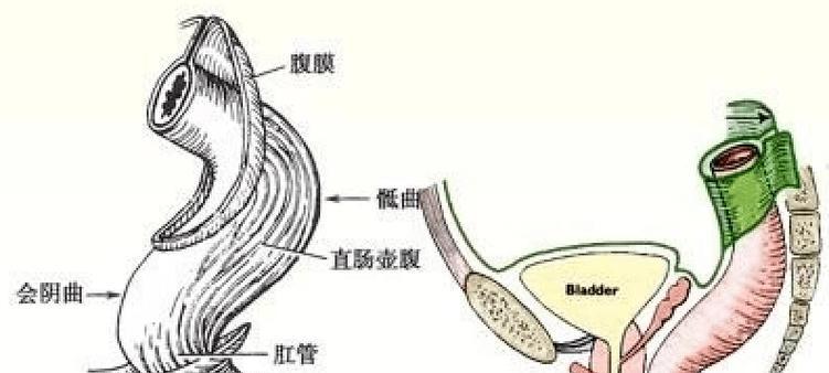 肛门腺清理的重要性及堵塞的危害（保护宠物健康，重视肛门腺清理）