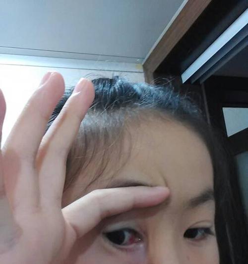 小狗咬伤出血，怎么处理？（掌握这6个方法，轻松应对小狗咬伤出血！）