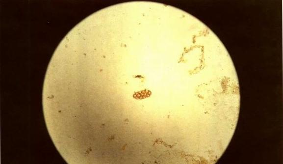 狗狗感染绦虫的原因及预防方法（揭秘狗狗感染绦虫的危害与防治措施）