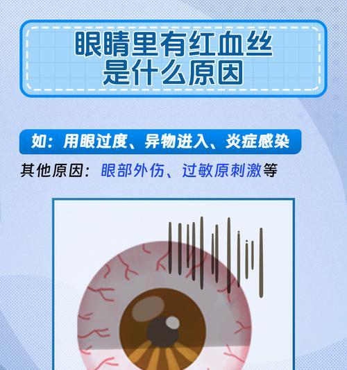 眼角发红的原因解析（揭秘眼角发红的五大常见原因）