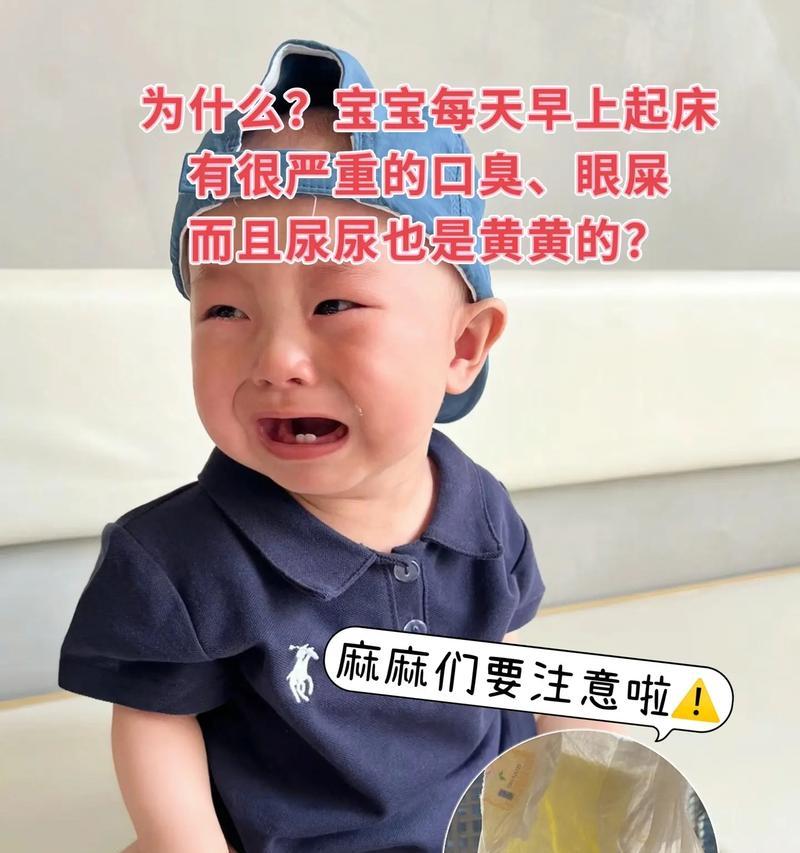 揭秘小巴哥眼屎之谜（了解小巴哥眼屎的成因及处理方法）