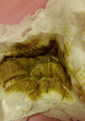 白色粘稠物出现在大便上的原因及健康问题（探究引起大便出现白色粘稠物的可能因素及其健康影响）