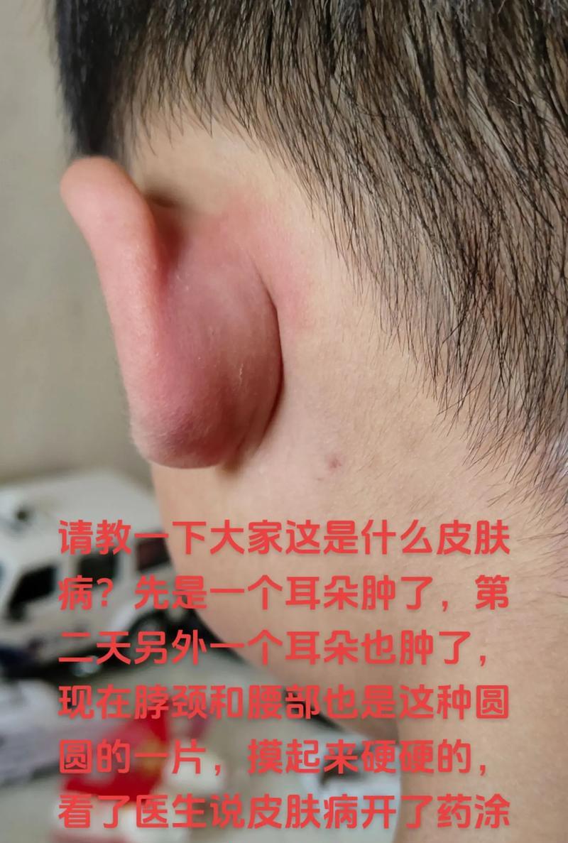耳朵的常见疾病及预防措施（了解耳朵疾病，保护听觉健康）