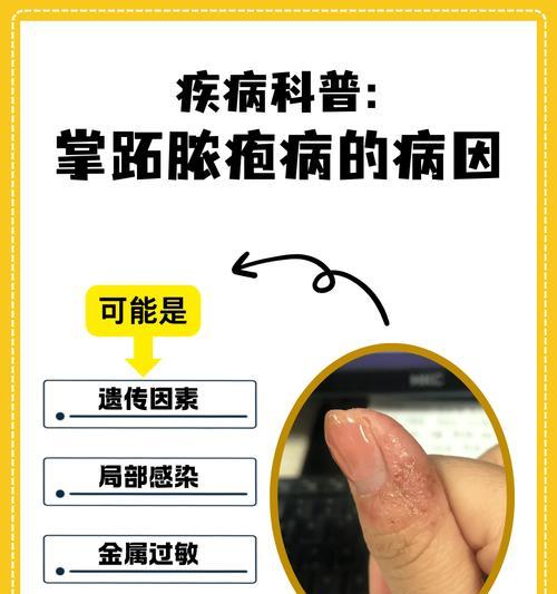 预防传染性皮肤病的有效方法（了解不传染的皮肤病，关注个人卫生，远离感染源）