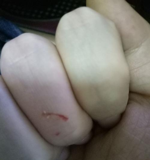 泰迪狗流血的康复时间及注意事项（探讨泰迪狗流血伤口的愈合速度以及关键要点）