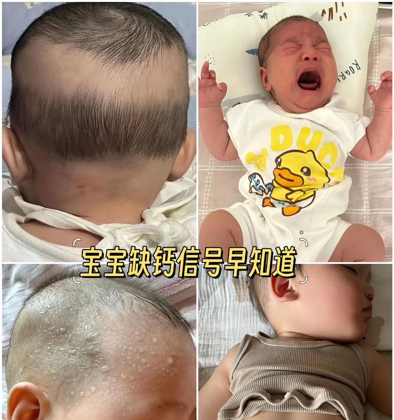 月子里缺钙的症状及预防措施（探索月子期间缺钙引起的问题，以及如何保持良好的钙质摄入量）