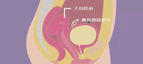 探寻阿拉斯加人的惊人憋尿能力（揭秘阿拉斯加人生活中的奇特之处，憋尿竟能达到何种程度？）